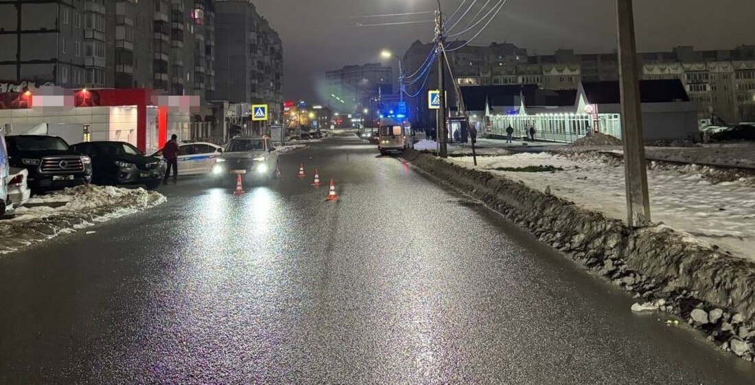Череповчанка, попавшая под колёса автомобиля, скончалась в больнице