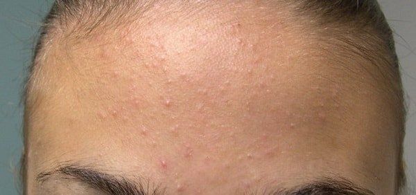 ��� ���������� � �������� ����������� � ����������: ������ � ������������