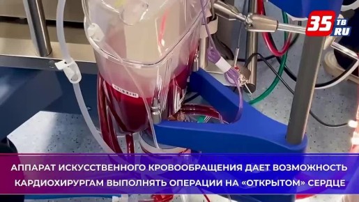 Операции с использованием аппарата искусственного кровообращения выполняют вологодские врачи