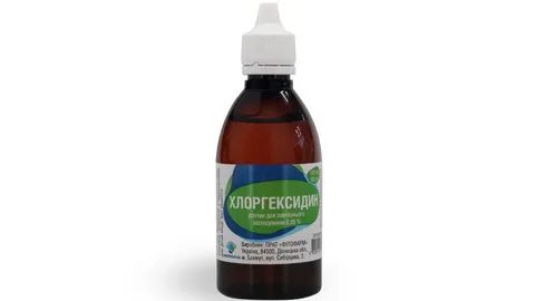 ������������������� ������������: ��� �� ����� ��������� ���� �����