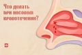 Носовое кровотечение у ребёнка: чего делать НЕ нужно?