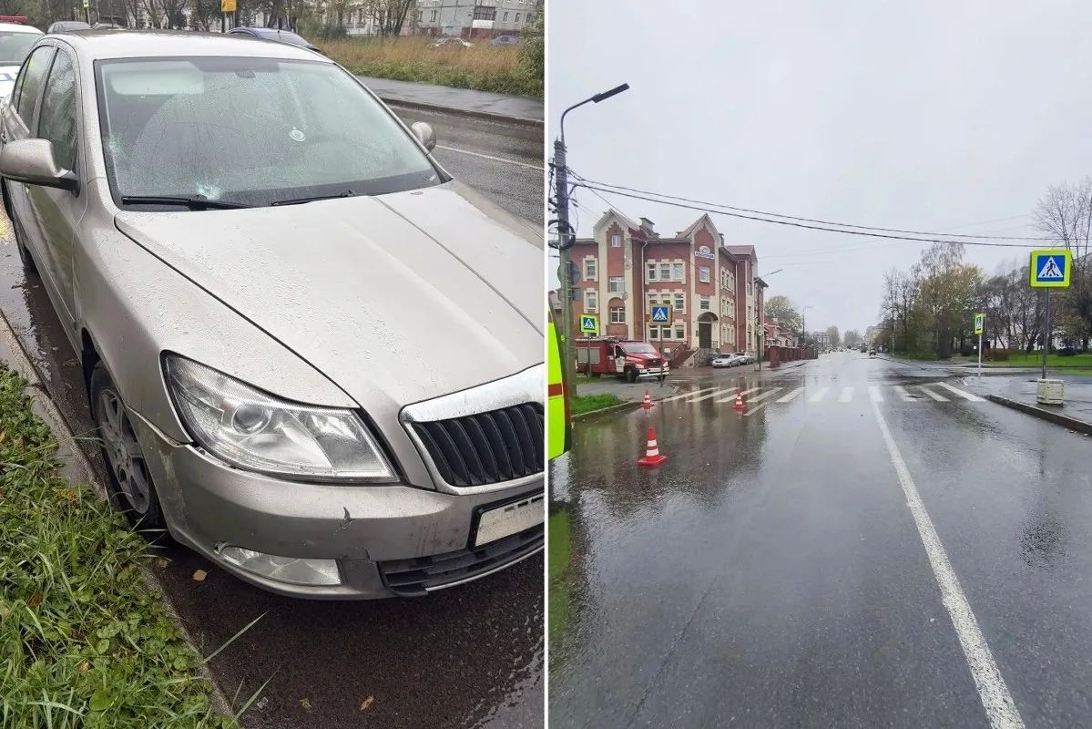 Сбитую в Череповце 18-летнюю девушку госпитализировали в больницу